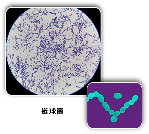 无乳链球菌,又称b族溶血性链球菌(groupbstreptococcus,gbs),存在于
